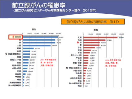 前立腺癌が男性の癌罹患率第1位に